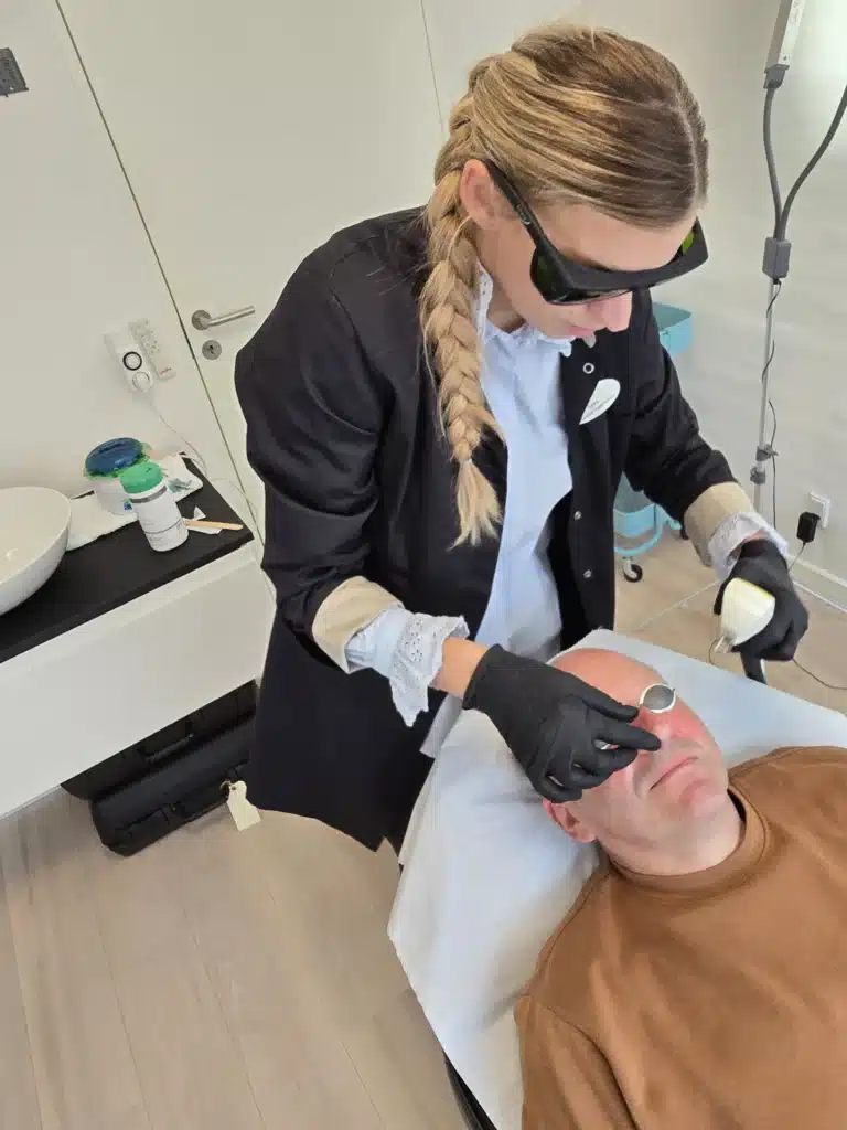 IPL Behandling af Karsprængninger og rosacea