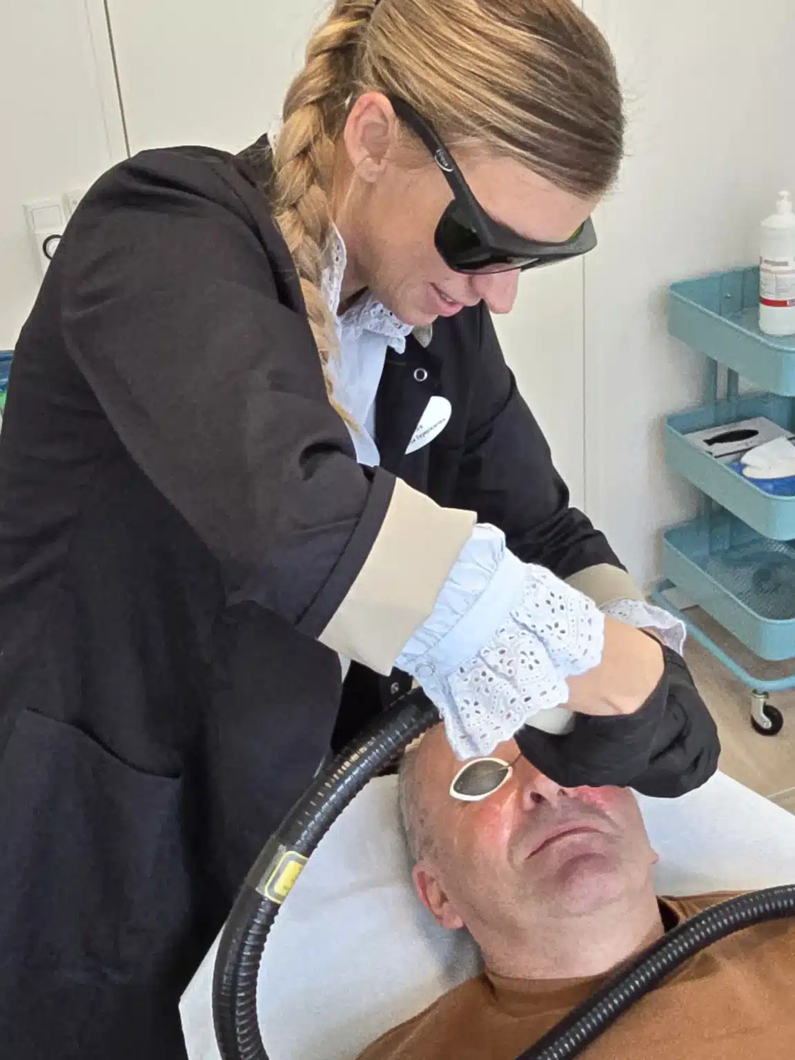 behandling af karsprængninger med laser