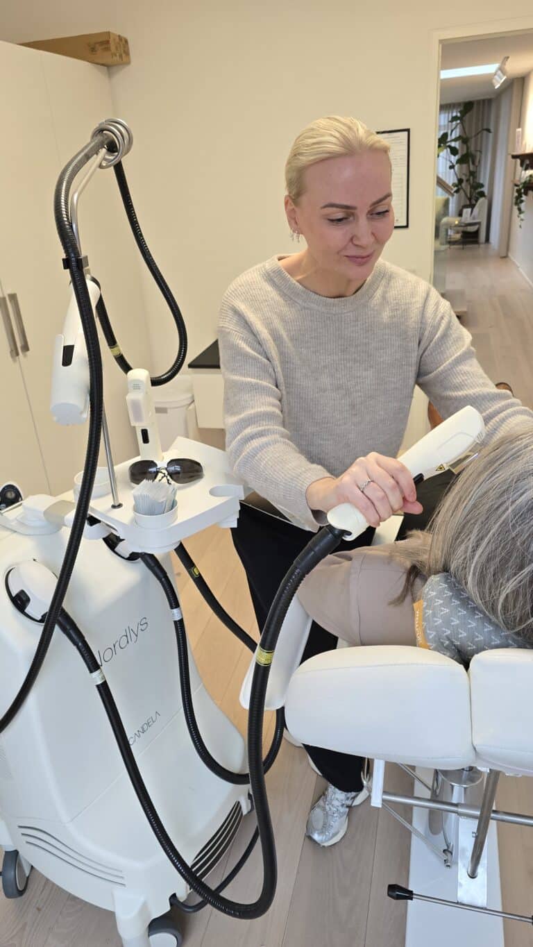hudforyngelse med IPL laser hos maja V