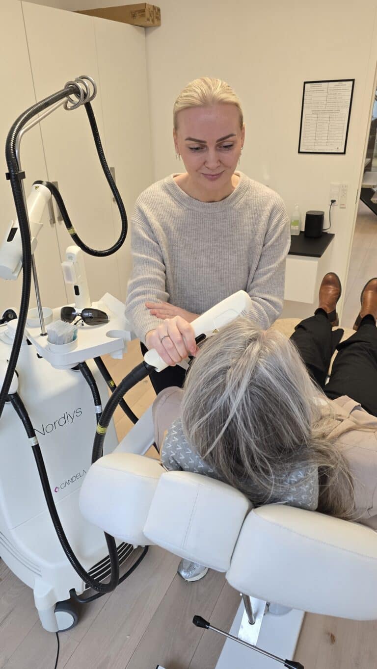 IPL-rejuvination-7800-skive